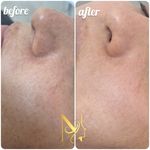خدمات تخصصی فیشال نیلو