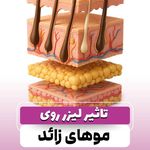 مرکز تخصصی لیزر موهای زائد پریناز شرق