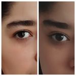 کلینیک پوست و مو الیزا