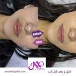 کلینیک زیبایی آنا بیوتی