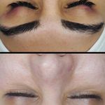 استودیو پوست هلیا فیشیال و پاکسازی تخصصی