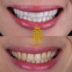 دندانپزشکی دکتر قاسم نژاد *بیمه نداریم*