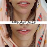 کلینیک پوست و مو و لیزر نیلوفر آبی