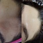 پاکسازی پوست/جوان سازی /جعفری
