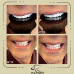 دندانپزشکی زیبایی دکتر پریسا دهقانی