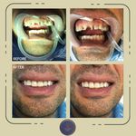 دندانپزشکی زیبایی دکتر پریسا دهقانی