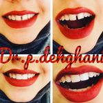 دندانپزشکی زیبایی دکتر پریسا دهقانی