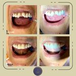 دندانپزشکی زیبایی دکتر پریسا دهقانی