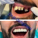 دندانپزشکی زیبایی دکتر پریسا دهقانی