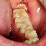 دندانپزشکی زیبایی دکتر پریسا دهقانی