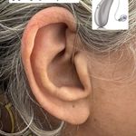 سمعک و شنوایی سنجی هما