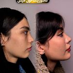 کلینیک زیبایی و مرکز لیزر هانیسا