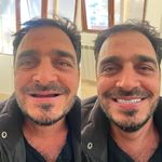 دندانسازی محلات (فتح المبین )