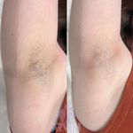 مرکز لیزر و کلینیک زیبایی آروین