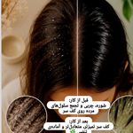 مرکزتخصصی‌کراتین‌و‌اسکالپ‌و‌اسکراب مینا