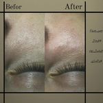 آموزش و خدمات پوست و فیشال رویا باقریان