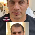 کلینیک زیبایی فریحا(پوست و مو)