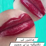 میکرو فیبروز هشتگرد بیتا