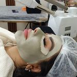 خدمات تخصصی فیشیال صورت مهدیه