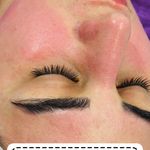 کلینیک فیشال و ماساژ سارن اسکین سارا