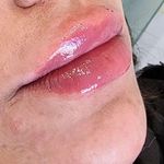 کلینیک زیبایی و مرکز لیزر ماری اسکین
