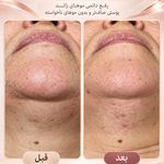 مرکز لیرز و جوانسازی پوست شهربانو