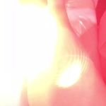 مرکز لیزر ، ژل ، فیلر  بوتاکس کلینیک بلا