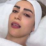 فیشال و پاکسازی تخصصی پوست سولماز