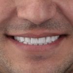 دکترای پروتزهای دندانی اکبری