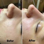 آموزش و خدمات پوست و فیشال رویا باقریان