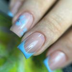 کاشت و ترمیم ناخن شهریار ملینا