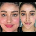 مرکز پوست و لیزر  سایناشور آمریکا دلدار