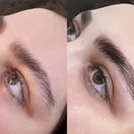 کلینیک زیبایی الماس کاملا اقساطی