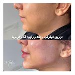 کلینیک زیبایی و لیزر مو زائد نوبا