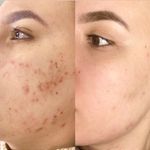 کلینیک زیبایی، فیشال امینی