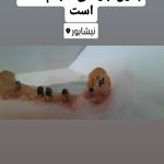 دندانپزشکی ایمپلنت و کلیه خدمات