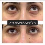 کلینک زیبایی ونک (40درصدتخفیف بوتاکس)
