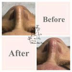 مركز پوست مونا خبیر