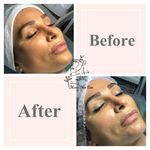 مركز پوست مونا خبیر