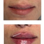 کلینیک پوست و مو و لیزر نیلوفر آبی