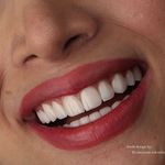 دکتر میثم اشرفیان