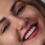 دکتر میثم اشرفیان