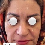 کلینیک پوست و مو دکتر زیبایی آصف