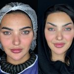 کلینیک زیبایی الماس کاملا اقساطی