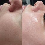 خدمات فیشال پاکسازی/اسکالپ اسکراپ ماهرخ