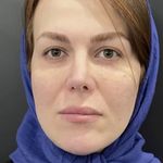 مطب زیبایی خاطره
