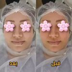 خدمات زیبایی ماه فیشیال