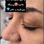 مطب زیبایی دکتر ملکی