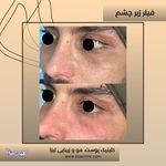 مطب پوست مو زیبایی فردوس شرق