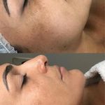 آموزش و خدمات پوست و فیشال رویا باقریان